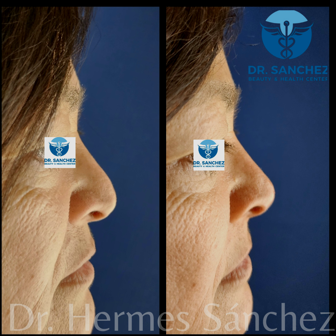 Galería - Transformación 5